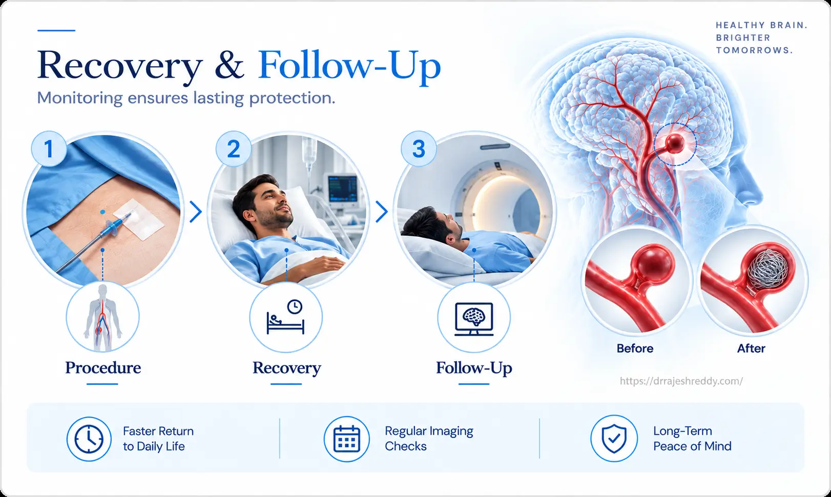 Recovery and Follow-Up After Endovascular Coiling